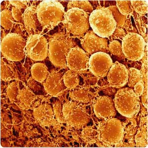 adipose-tissue